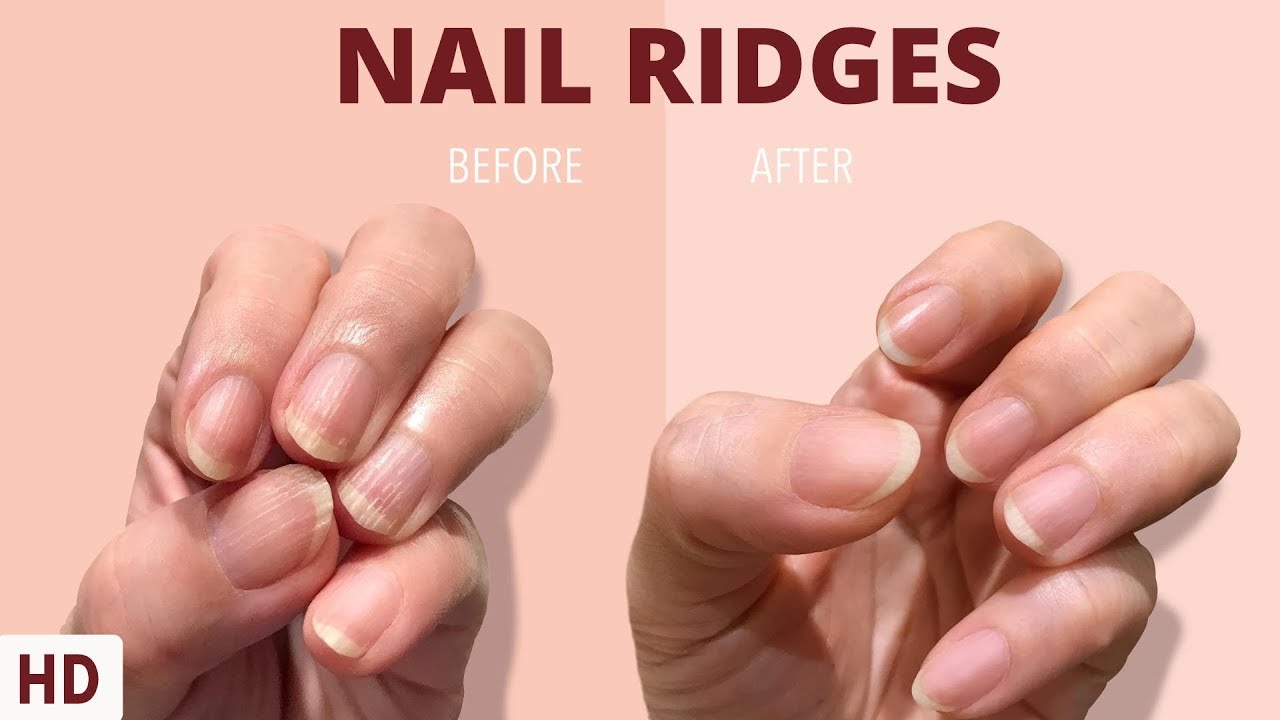 Mayo Clinic Minute: Fingernails are clues to your health