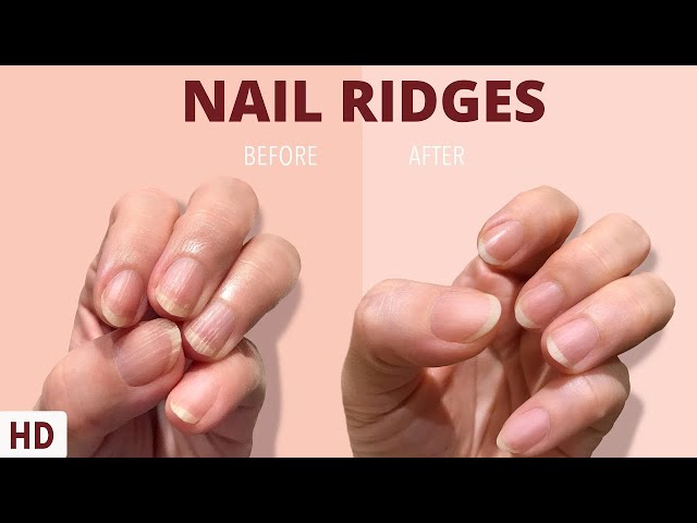 How to Use Nail Ridge Filler for Even Texture