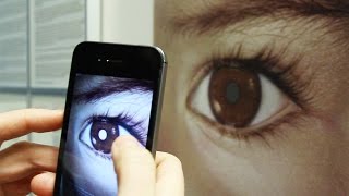 Detect Eye Cancer (Retinoblastoma) with Your Smart Phone – CHECT UK