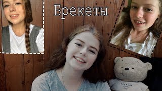Брекеты. Моя история| Полина Романченкова