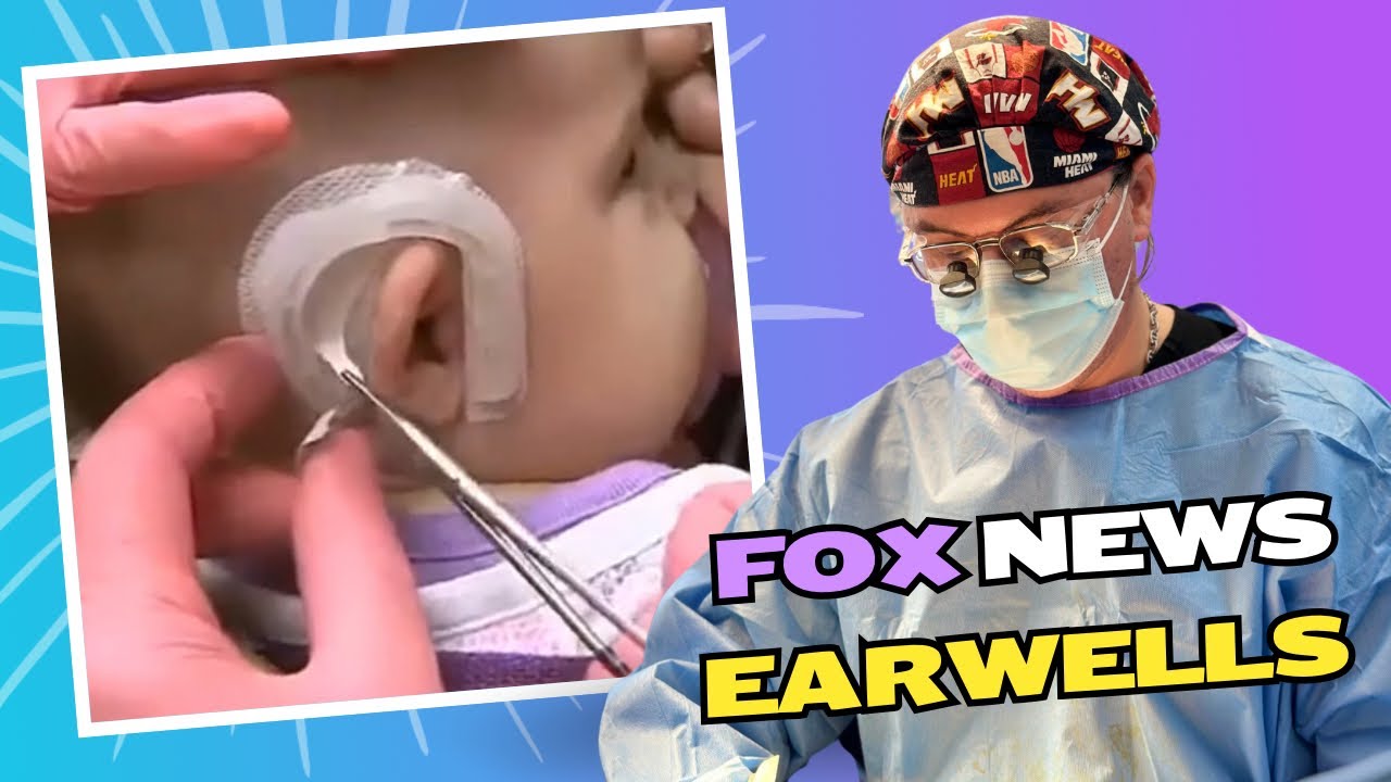 EarWell System for Infant Ear Correction 👶 | Dr. Arthur Desrosiers on FOX News Miami (WSVN)