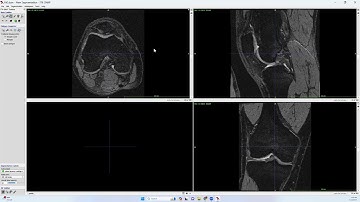Mastering ITK-SNAP: Session #2 [Manual Segmentation of MRIs]