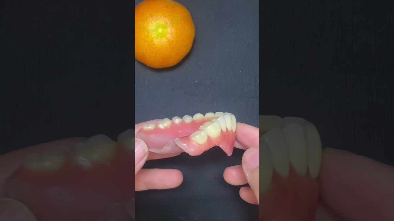 Relax with wax denture #dentallaboratory #dentalprosthesis #thusharing #denture