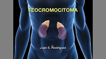 Como pesquisar feocromocitoma?