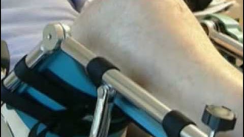 CPM for the Knee - Continuous Passive Motion Machine