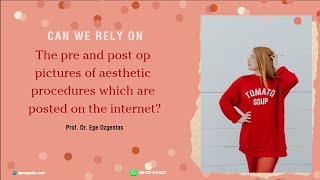 Pre And Post Operative Patient Pictures On Social Media