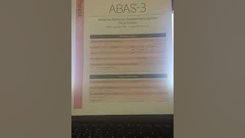 Shiniqual Love ABAS 3 review