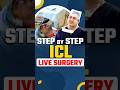 Step by step icl live surgery