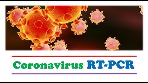 #Coronavirus Reverse Transcriptase - Polymerase Chain Reaction (RT-PCR)