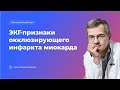 ЭКГ-признаки окклюзирующего инфаркта миокарда