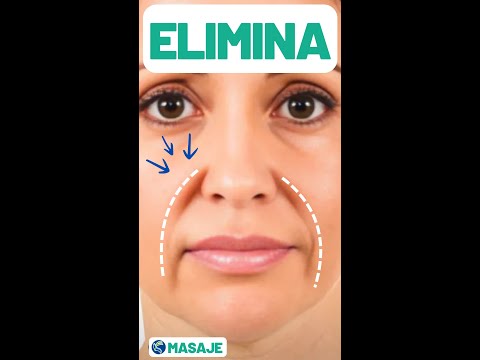 Elimina LÍNEAS de