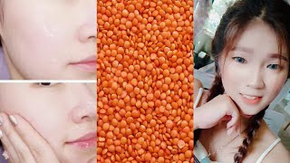 Skin whitening and Brightening Face Mask with Rice Powder and Masoor Dal | In 3 Days  Lightening