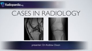 Cases in Radiology: Episode 4 (musculoskeletal, MRI, x-ray)