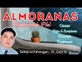 Hemorrhoids (Almoranas) - Dr. Gary Sy
