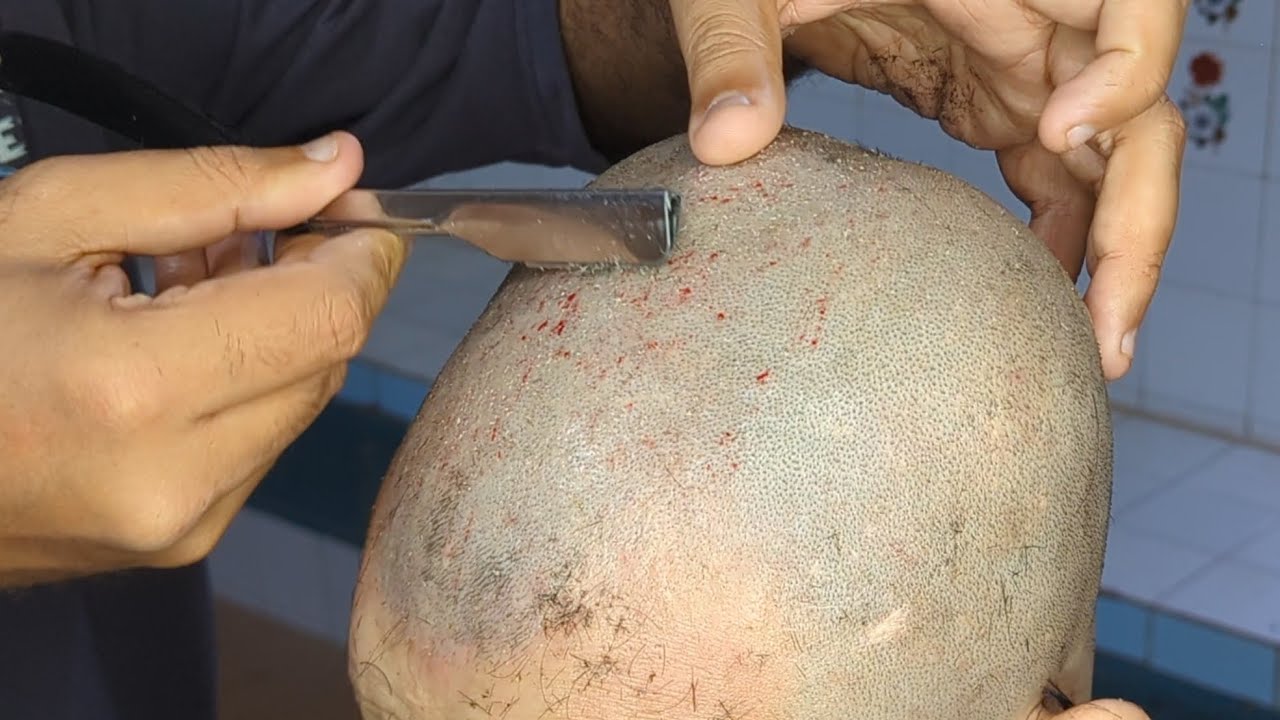 Sensitive skin hard dandruff remove head shave relaxing sound ASMR tutorial zaibi barber shop 2026