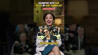 Hair Patch Or Transplant? Heres What Celebs Chose ? Part 2