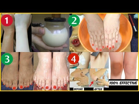 Best Skin Whitening Home Remedies Of 2017 By Simple Beauty Secrets