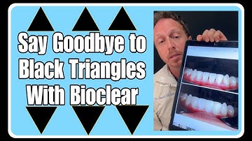 Say goodbye to Black Triangles with Bioclear