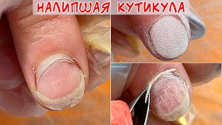 картинка: Налипшая кутикула / Аллергия на гель лак / Дип система для ногтей