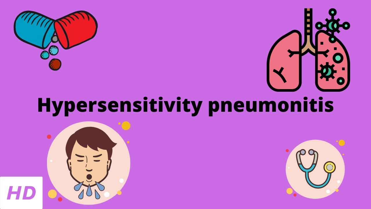 Hypersensitivity pneumonitis, Causes, Signs and Symptoms, Diagnosis and