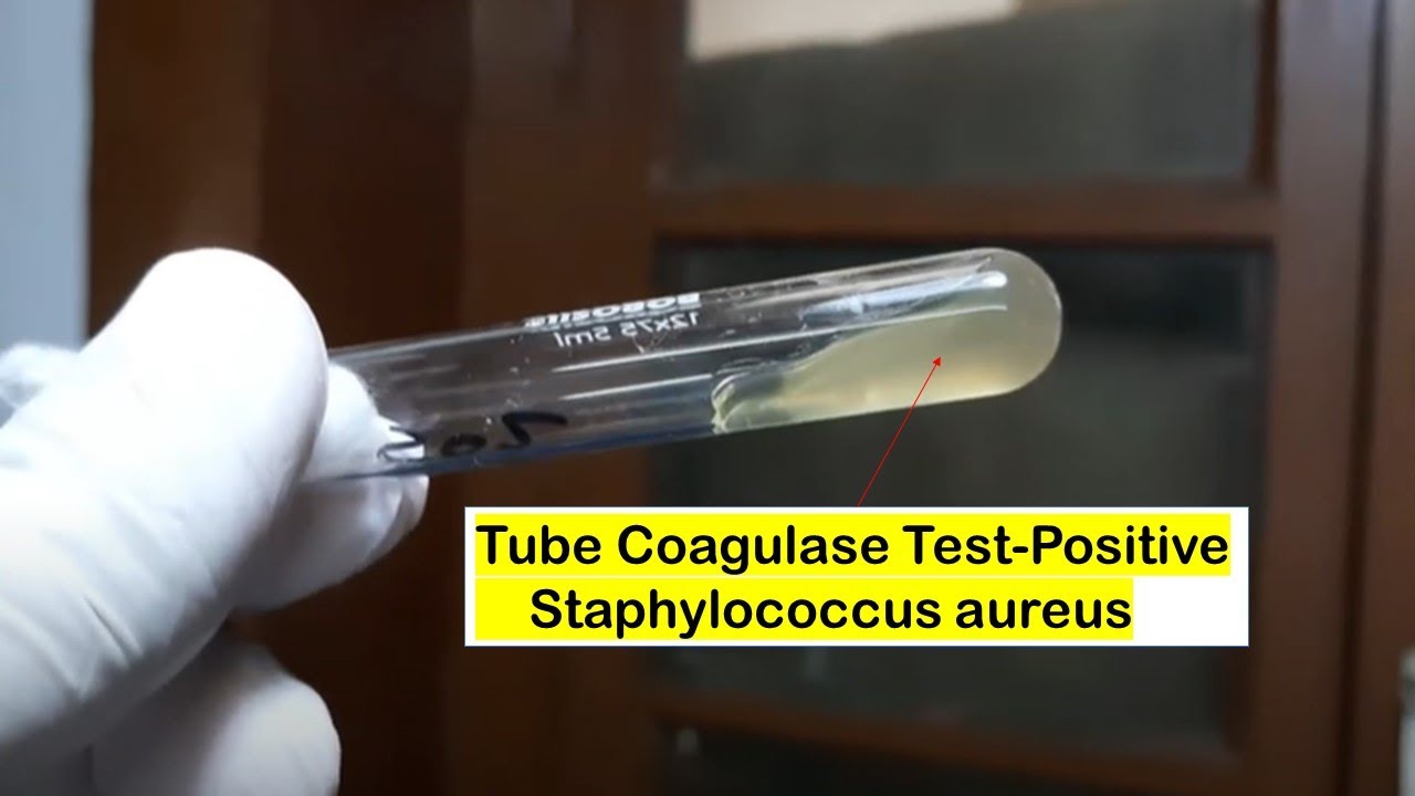 How to identify Staphylococcus aureus using the Coagulase Test - Slide and  Tube Method - 4K 