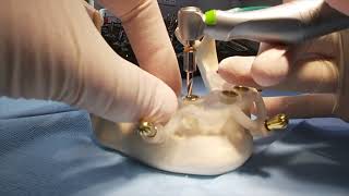 SGS Dental Guided Implant Surgery. P7D Dental Implant.