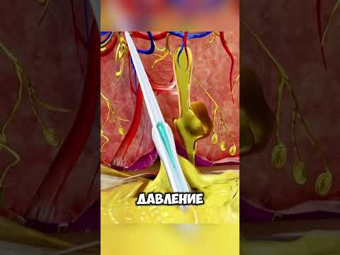 Что будет если наступить на каменного окуня Zackdfilms