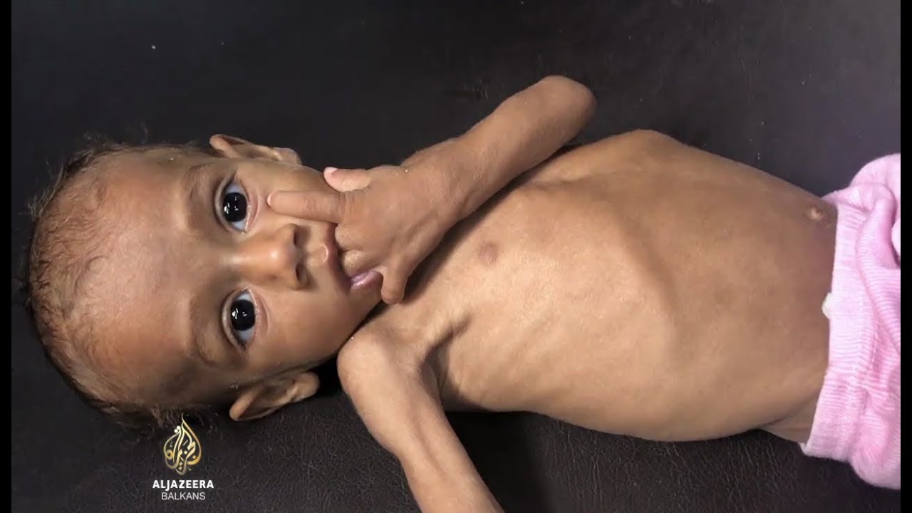 ملايين الأطفال معرضون للخطر في مناطق الحرب