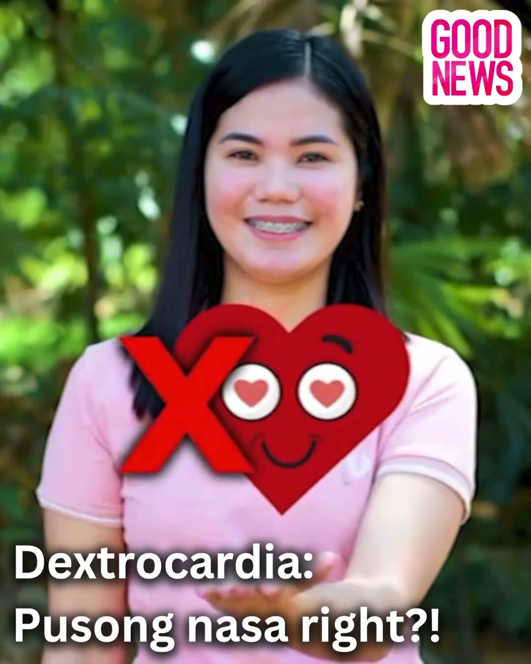 Ang kondisyon ng isang tao na ang puso ay nasa kanan, tinatawag na dextrocardia! | Good News