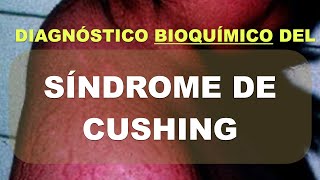 Síndrome de Cushing. Diagnóstico bioquímico