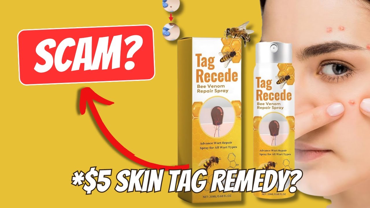 Tag Recede Bee Venom Treatment Spray Reviews Flysmus Tag Recede Bee Venom Treatment Spray Review: Does this Works