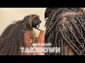 Watch my take down box braids/safely remove build up without breakage