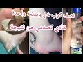 ملعقة خل وبيضة واحدة وداعي الاسمرار و التشققات القدمين من أول استعمال النتيجة أمام أعينكم