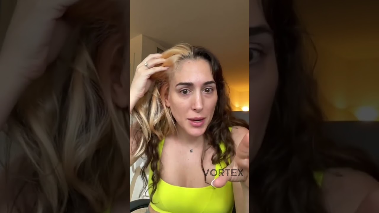 VortexHairCare Helped My Reverse Hair Loss