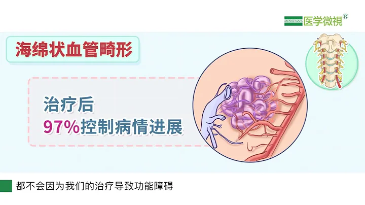 海绵状血管畸形、动静脉血管畸形能治好吗？ - 天天要闻