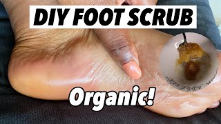 HOW TO MAKE A FOOT SCRUB (REMOVES DEADSKIN ) screenshot 4