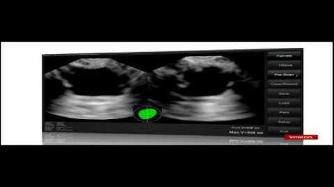 VitaScan LT Inservice