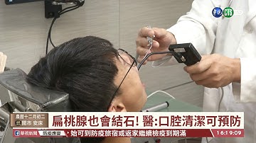 【台語新聞】男子口臭就醫 竟是｢扁桃腺結石｣作祟｜華視台語新聞 2021.01.14