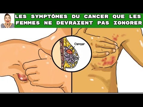 Vidéo: Zapodlianski Ne Glisse Pas Dans Les Aisselles: Daineko A Parlé Des Avantages Des Seins En Silicone