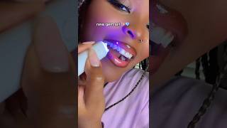 DIY tooth gems AT HOME ✨💎🦷 #toothgems #diy #style #shorts #tutorial #teeth #crafts #beauty #viral Wealth