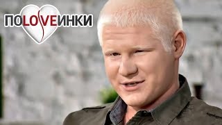 Человек АЛЬБИНОС ► Половинки ► Альбинос ► #1