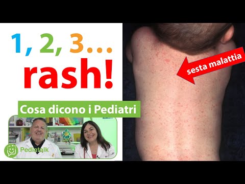 Video: Devo andare dal dottore per la roseola?