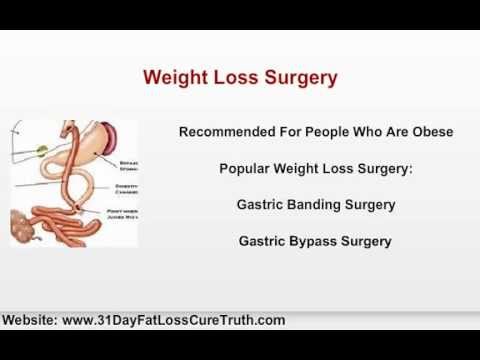 weight loss surgery vs diet and exercise