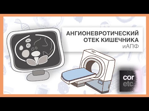 иАПФ и ангионевротический отек кишечника