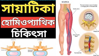 সায়াটিকা বাতের হোমিওপ্যাথি ওষুধ | সায়াটিকার হোমিওপ্যাথি চিকিৎসা |