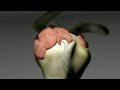 Rotator Cuff Repair