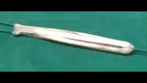 Trifascicular graft construction for X-CL surgery