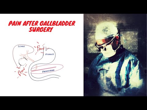 Pain after gallbladder surgery months later