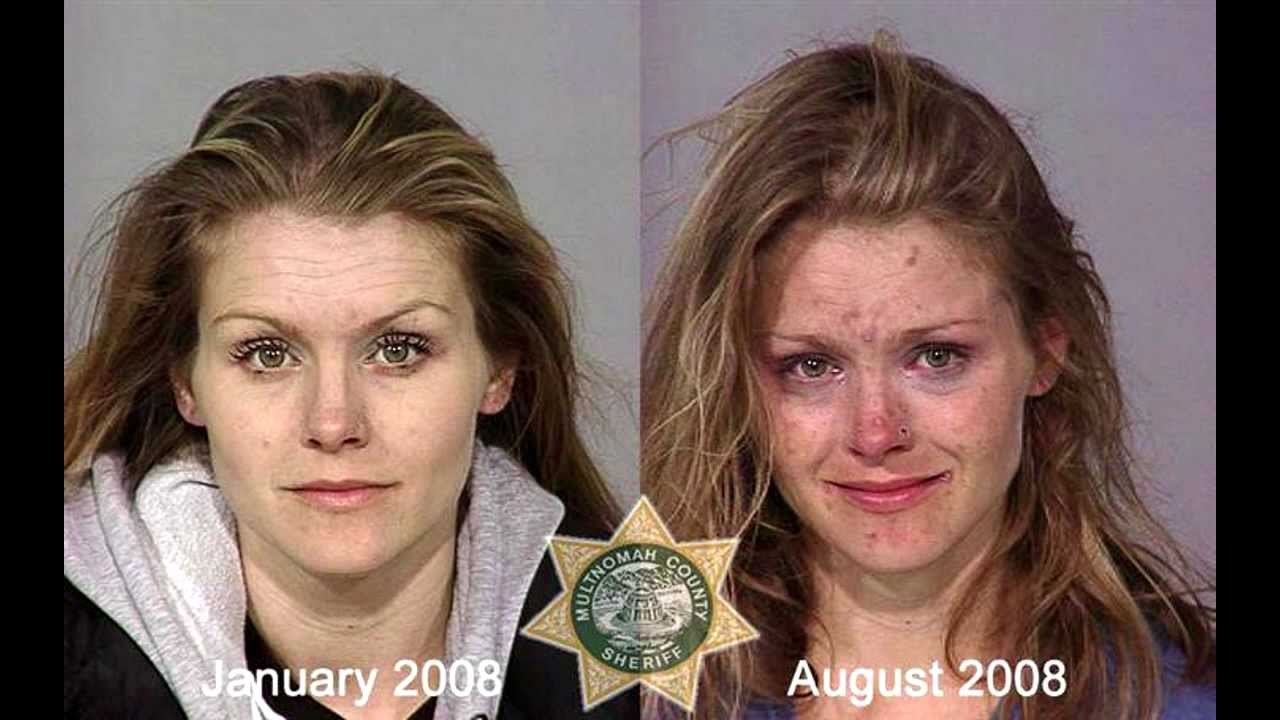 before and after drugs