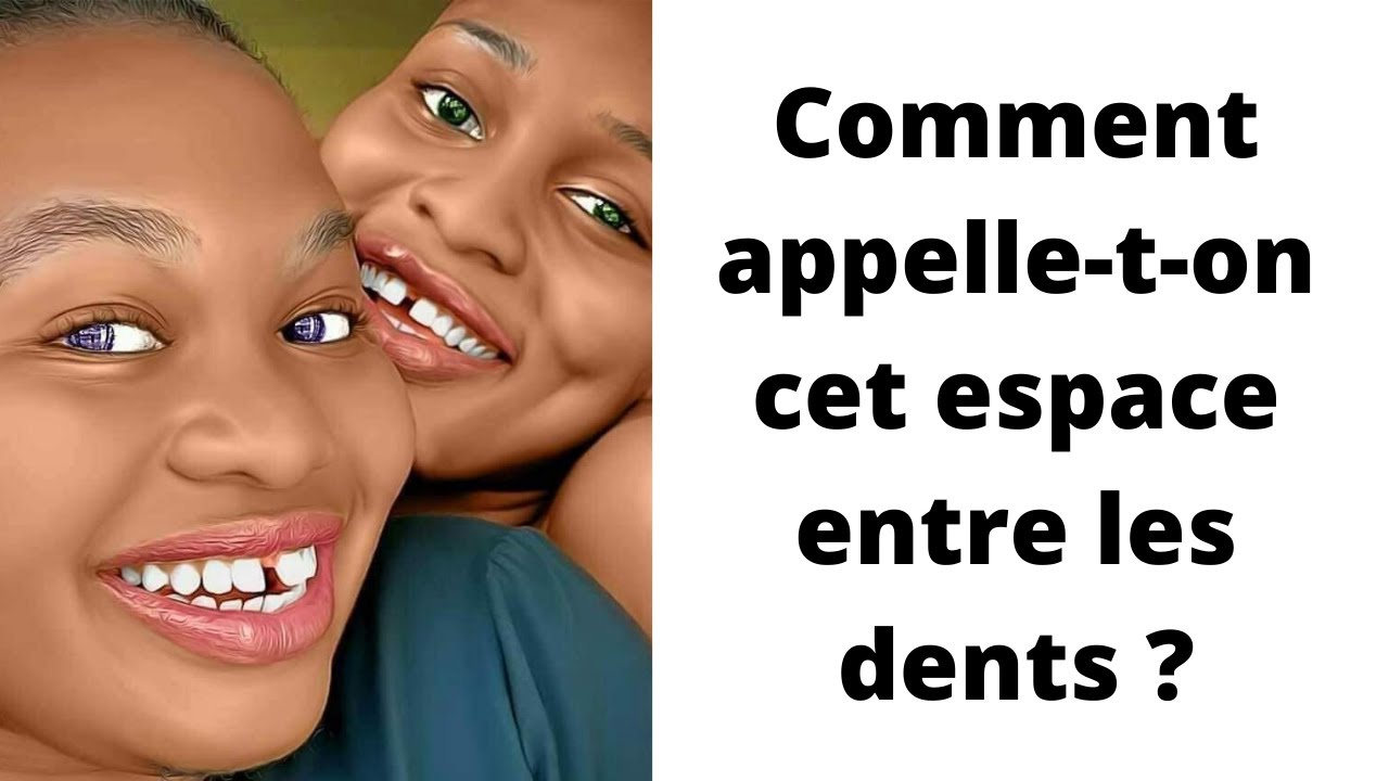 Pourquoi Y ATIl Des Espaces Entre Les Dents KQJJX — free download